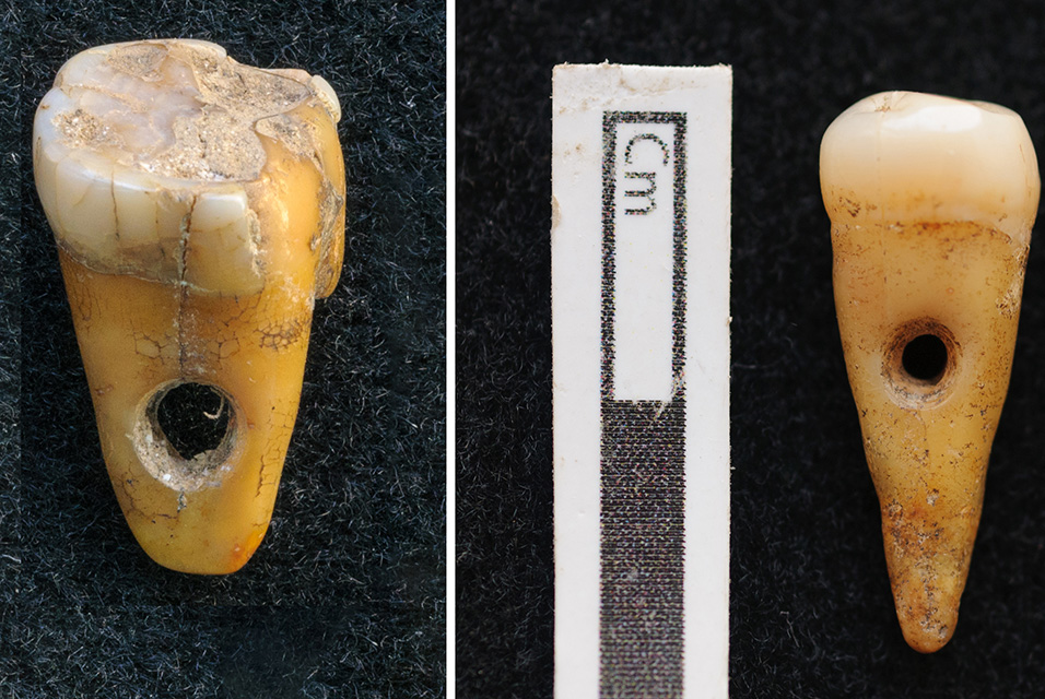 Rare find: Human teeth used as jewellery in Turkey 8,500 years ago